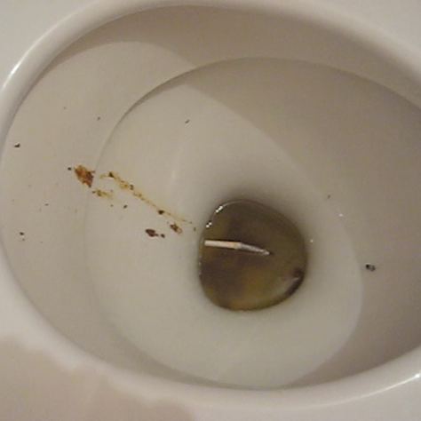 insert your penis into her vagina girl farts while having sex